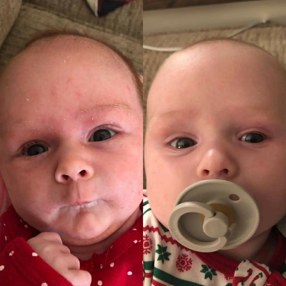 PREORDER ONLY ByeBye Stretch Marks,Mosquitos,Burns - Picture 6 of 16